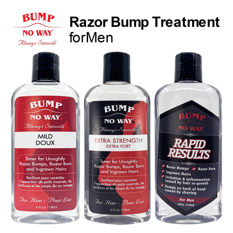 BUMP NO WAY Razor Bump Treatment for Men (4oz)